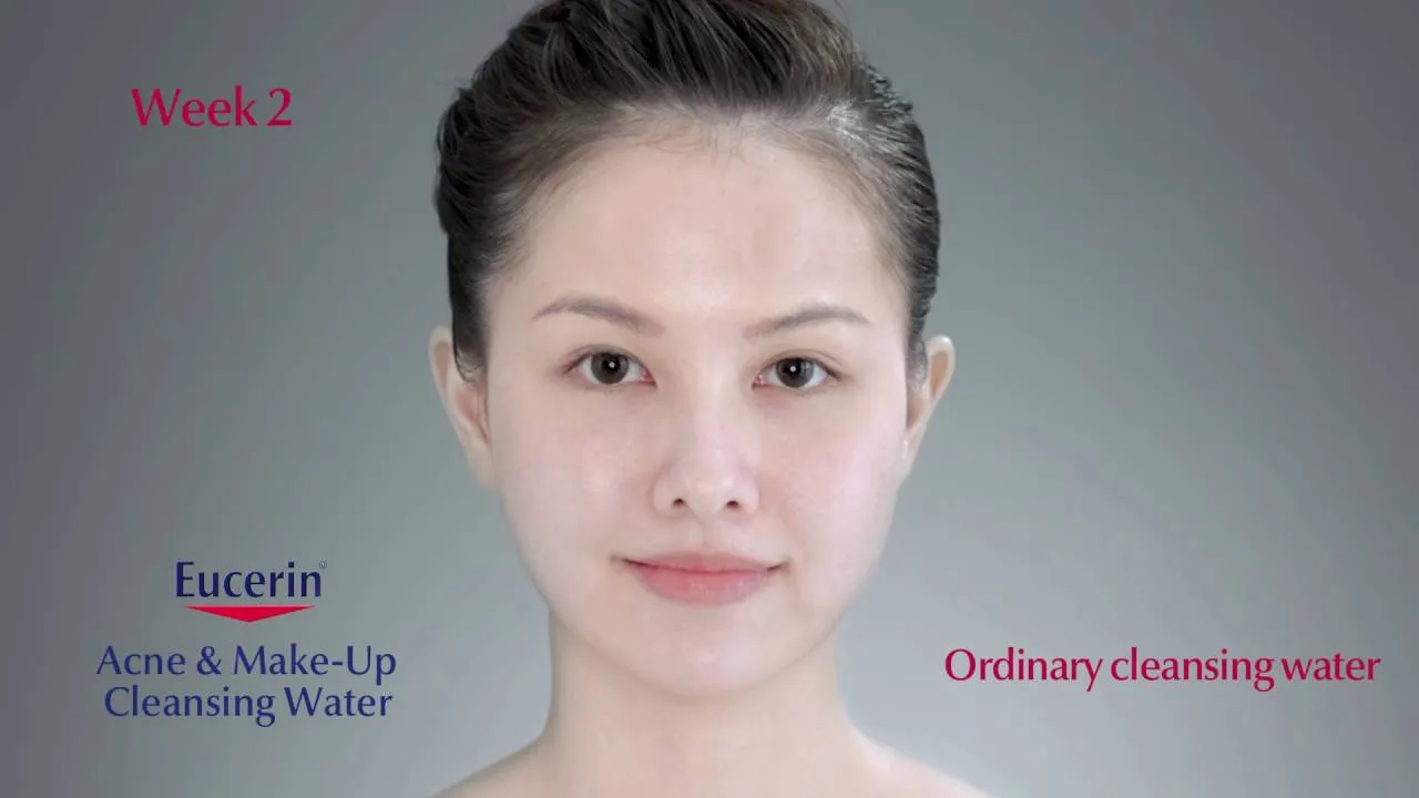 Nước Tẩy Trang Eucerin 200ml